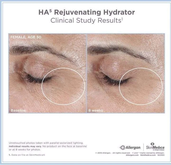 SkinMedica HA5 Rejuvenating Hydrator - 2 oz - New Sealed - 100% Authentic
